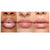 Wonderland Lipgloss
